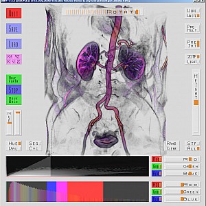 Abdomen-2DTF