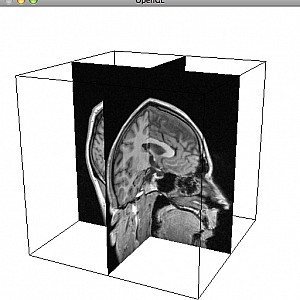 MRI-Head