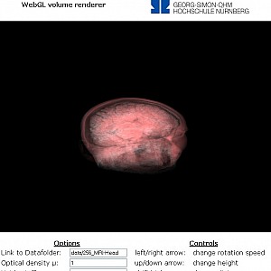 MRI-Head2