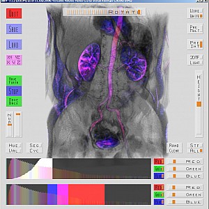 Abdomen-1DTF